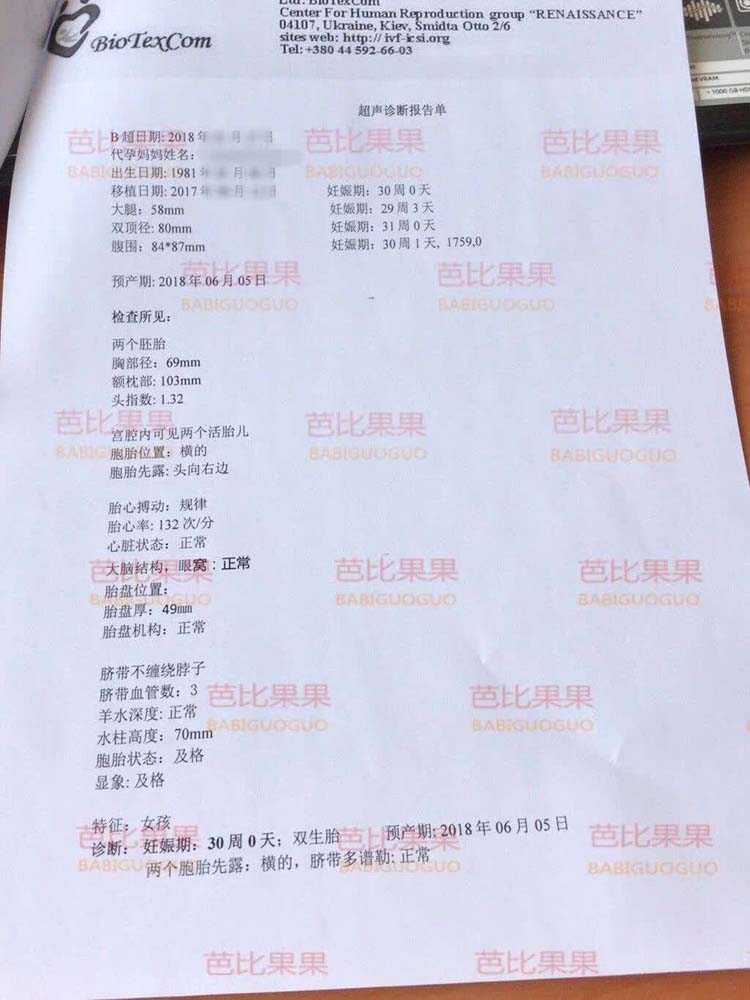 S姐双胞胎女儿的检查一切正常 预产期在6月份