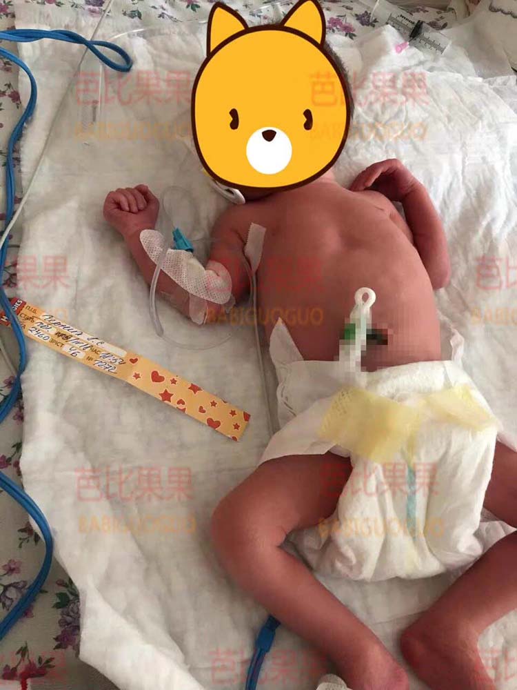 山东大哥的乌克兰爱心妈妈于4月19日晚上顺利生下双胞胎男宝