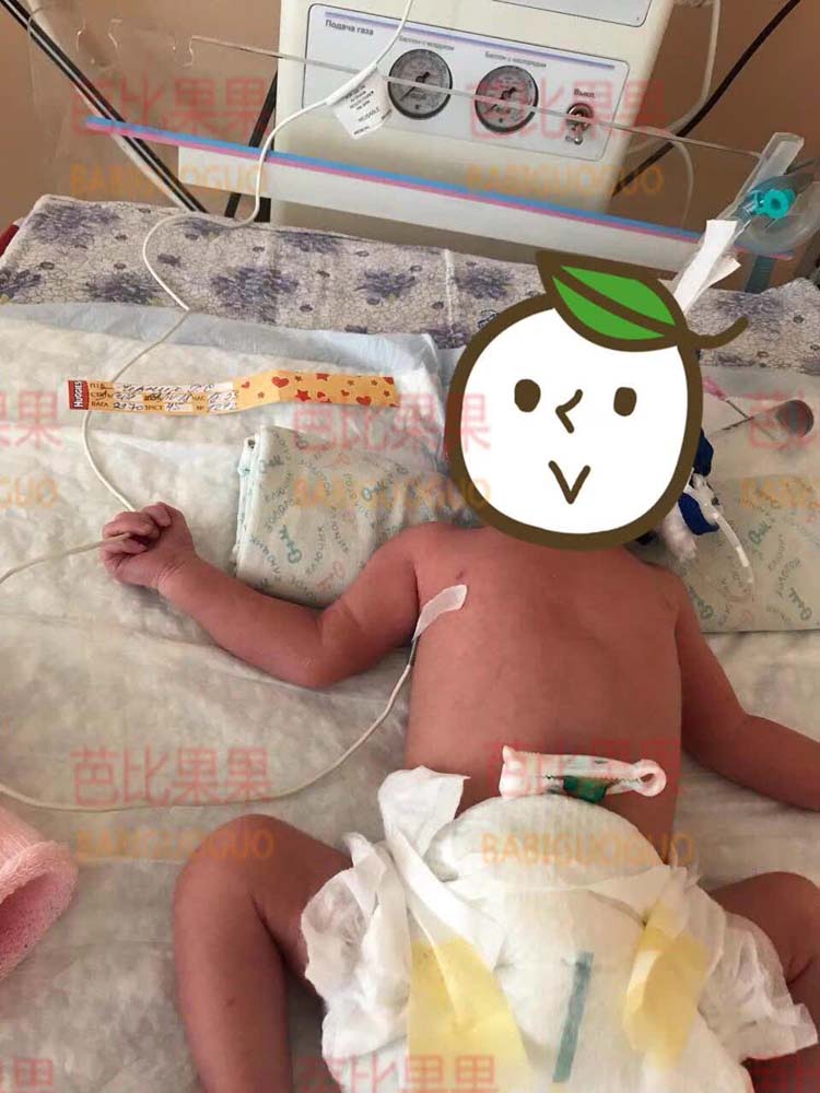 乌克兰试管双胞胎
