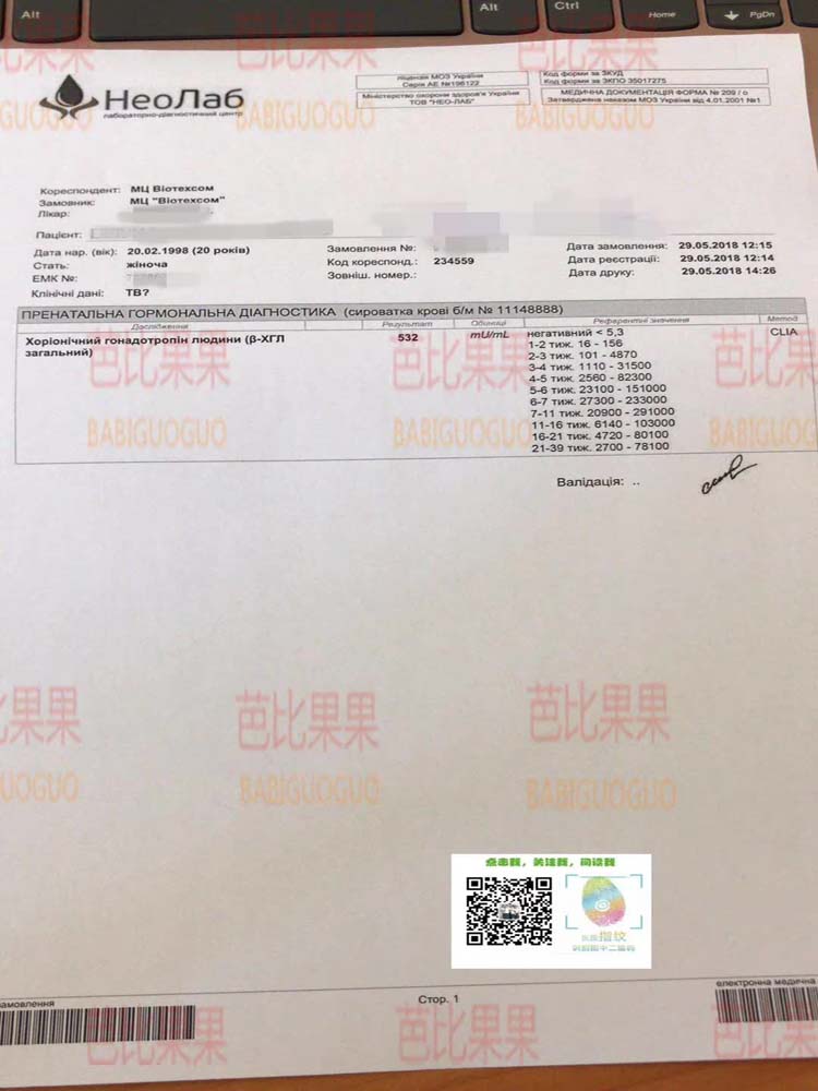 L姐在乌克兰百奥试管医院 第二次移植验孕成功