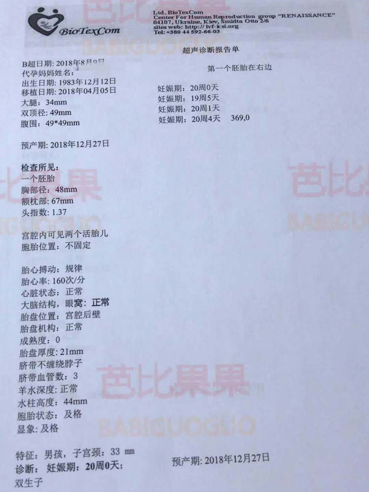 W先生乌克兰爱心妈妈怀双胞胎男宝 孕20周的B超