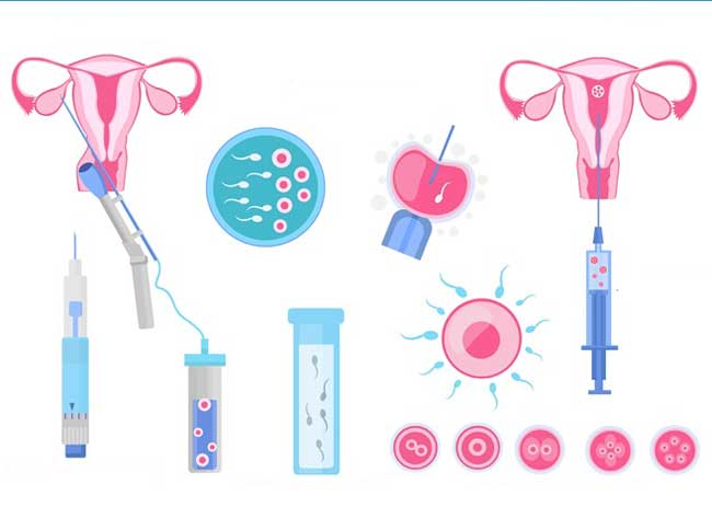 |如果岁月可回头|离婚了还能继续做试管婴儿吗