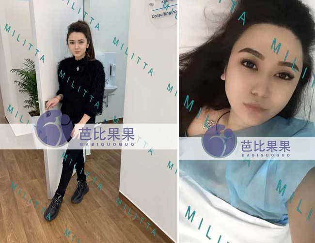 乌克兰卵妹取卵