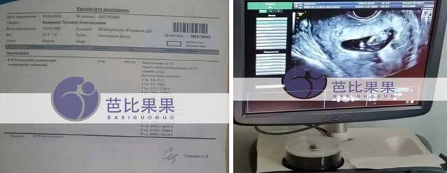 乌克兰代理孕母试管移植验孕失败