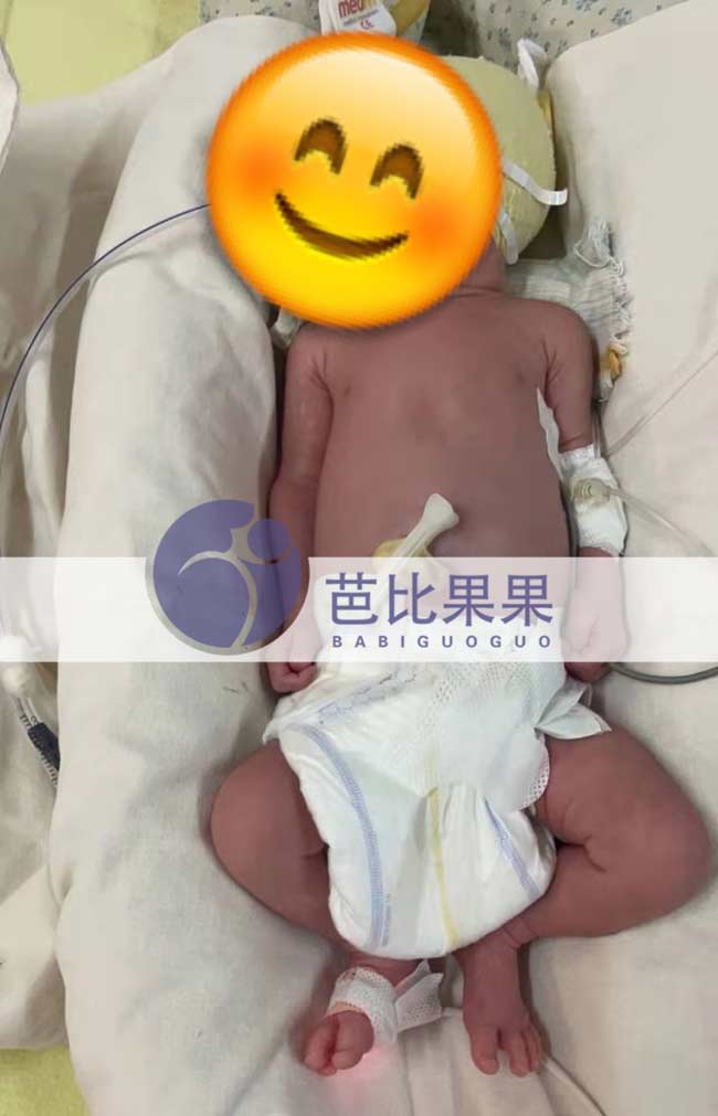 乌克兰试管宝宝出生