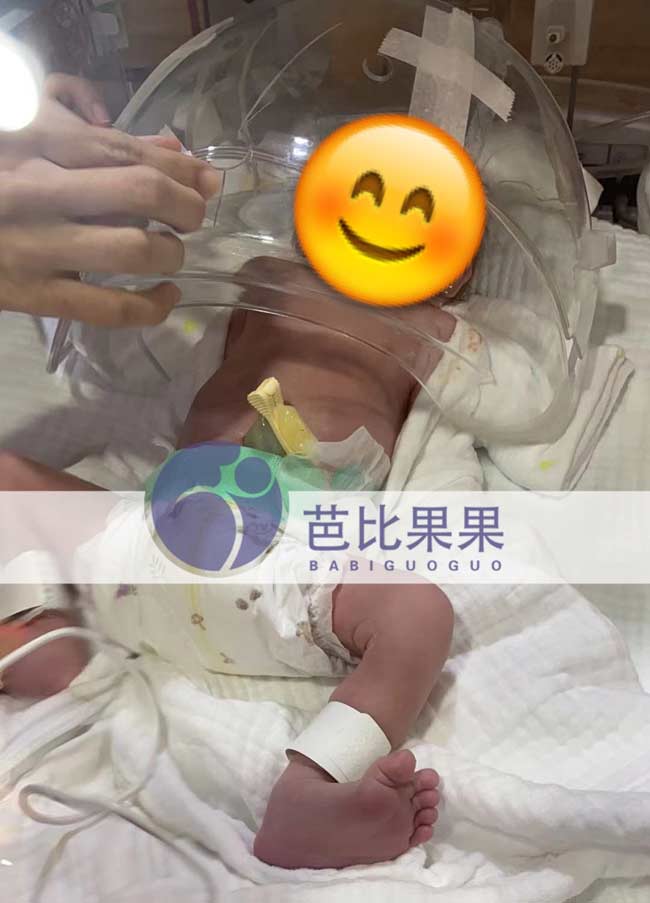泰国试管宝宝出生