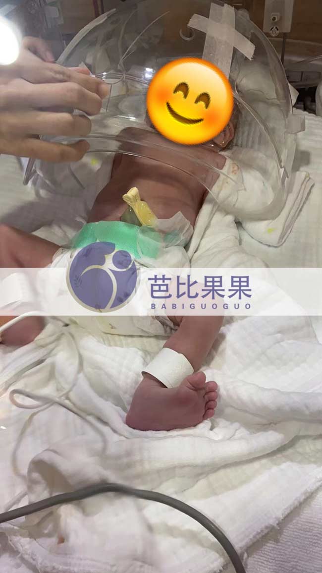 泰国试管宝宝出生