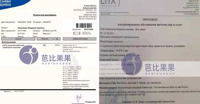 乌克兰孕妈验孕成功