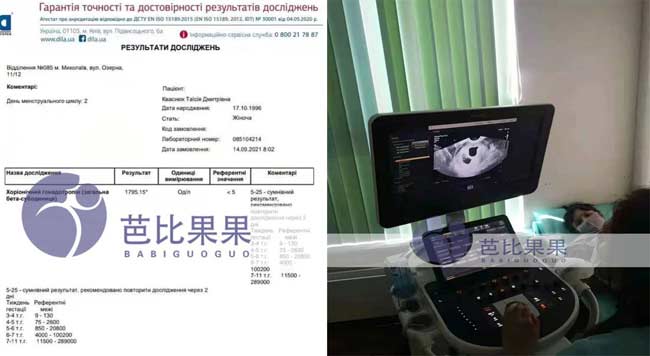 乌克兰孕妈验孕成功