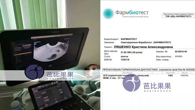 乌克兰孕妈验孕成功