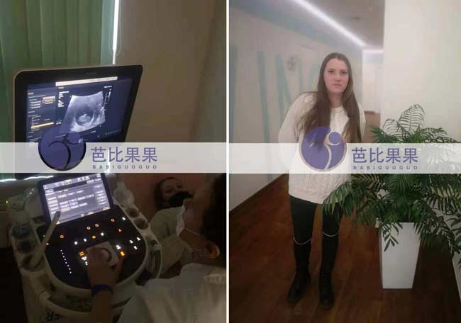 乌克兰孕妈第二次B超