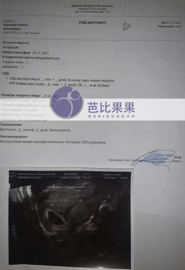 孕妈B超报告验孕成功