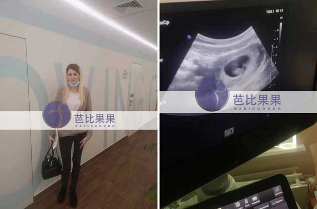 孕妈第一次B超