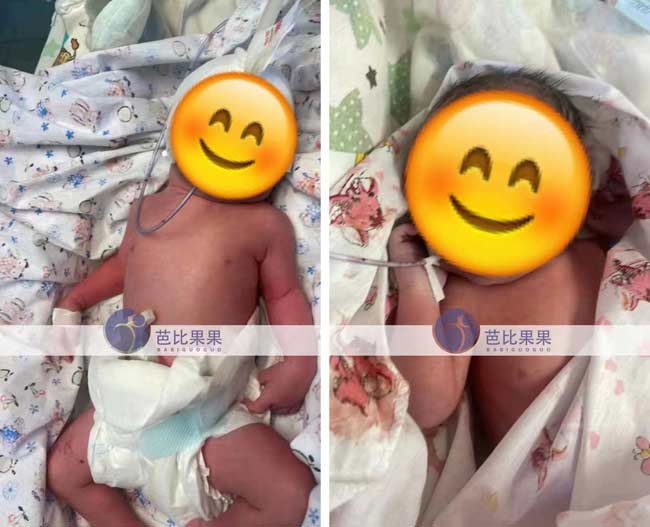 乌克兰试管龙凤胎