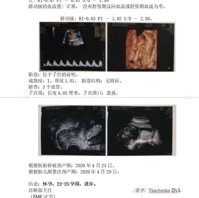 乌克兰试管助孕孩子的一封信